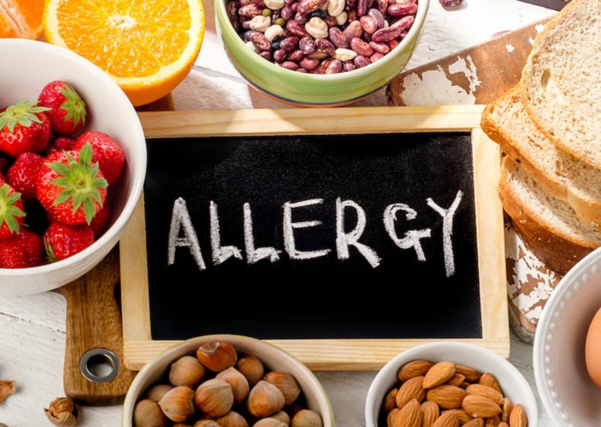 https://clinicahispanacorazonyvida.com/wp-content/uploads/2024/05/Food-allergy-dreamstime-1200x853-1.jpg